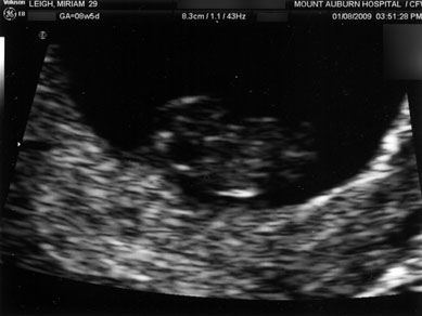 ultrasound-1.jpg