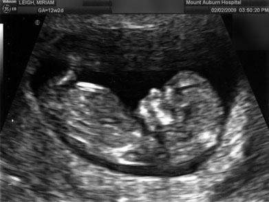 ultrasound-2.jpg