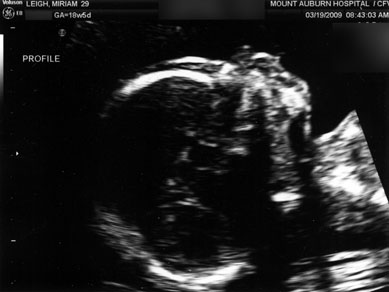 ultrasound-3.jpg