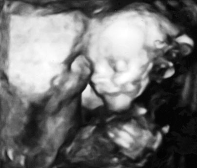 ultrasound-4.jpg