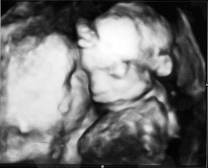 ultrasound-5.jpg